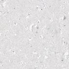 Immunohistochemical staining of human cerebral cortex shows no positivity in neurons as expected.