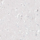 Immunohistochemical staining of human cerebral cortex shows no positivity in neurons as expected.
