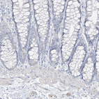 Immunohistochemical staining of human colon shows no positivity in glandular cells as expected.