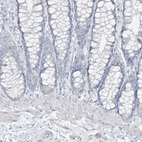 Immunohistochemical staining of human colon shows no positivity in glandular cells as expected.