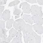 Immunohistochemical staining of human skeletal muscle shows no positivity in myocytes as expected.