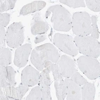 Immunohistochemical staining of human skeletal muscle shows no positivity in myocytes as expected.