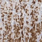 Immunohistochemical staining of human stomach shows moderate cytoplasmic positivity in glandular cells.