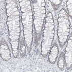 Immunohistochemical staining of human colon shows low positivity in glandular cells as expected.