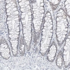 Immunohistochemical staining of human colon shows low positivity in glandular cells as expected.