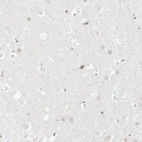 Immunohistochemical staining of human cerebral cortex shows no positivity in neurons as expected.
