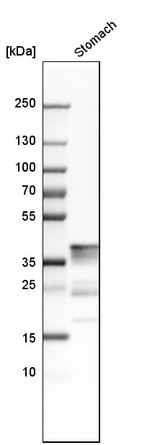 Western blot analysis in human stomach tissue.