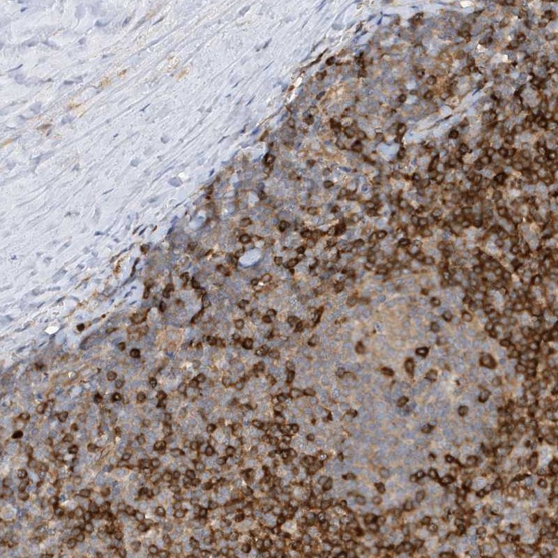 Anti-PHACTR2 Antibody