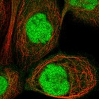 Immunofluorescent staining of human cell line A-431 shows localization to nucleoplasm.