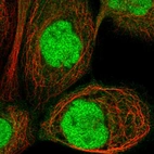 Immunofluorescent staining of human cell line A-431 shows localization to nucleoplasm.