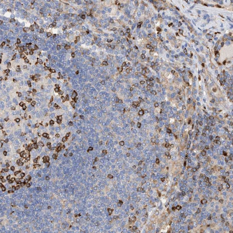 Anti-PHACTR2 Antibody
