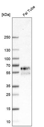 Western blot analysis in human fallopian tube tissue.