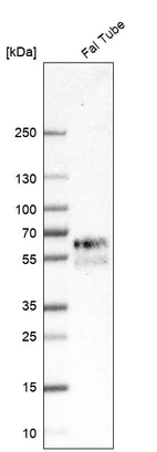 Western blot analysis in human fallopian tube tissue.