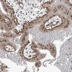 Anti-TAF8 Antibody