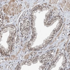 Immunohistochemical staining of human prostate shows weak to moderate nuclear positivity in glandular cells.
