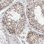 Immunohistochemical staining of human testis shows moderate to strong nuclear positivity in cells in seminiferous ducts.