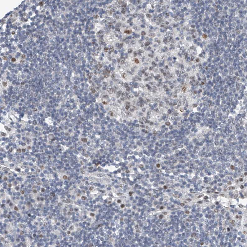 Anti-TAF8 Antibody