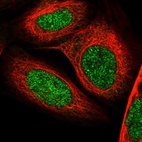 Immunofluorescent staining of human cell line U-2 OS shows localization to nucleoplasm.