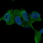 Anti-TTBK1 Antibody