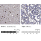 Anti-TTBK1 Antibody