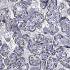 Immunohistochemical staining of human placenta shows low positivity in trophoblastic cells as expected.
