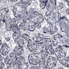 Immunohistochemical staining of human placenta shows low positivity in trophoblastic cells as expected.