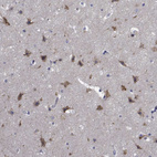 Immunohistochemical staining of human cerebral cortex shows moderate cytoplasmic positivity in neurons.