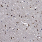 Immunohistochemical staining of human cerebral cortex shows moderate cytoplasmic positivity in neurons.