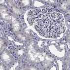 Immunohistochemical staining of human kidney shows low positivity as expected.
