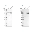 Western blot analysis using Anti-COLGALT2 antibody HPA031749 (A) shows similar pattern to independent antibody HPA031750 (B).