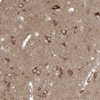 Anti-COLGALT2 Antibody