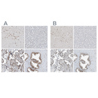 Anti-WRNIP1 Antibody