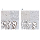 Anti-WRNIP1 Antibody