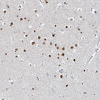 Immunohistochemical staining of human cerebral cortex shows moderate nuclear positivity in neurons.