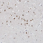 Immunohistochemical staining of human cerebral cortex shows moderate nuclear positivity in neurons.