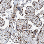 Immunohistochemical staining of human placenta shows strong nuclear positivity in trophoblastic cells.