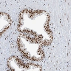 Immunohistochemical staining of human prostate shows moderate nuclear positivity in glandular cells.