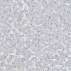 Immunohistochemical staining of human liver shows no positivity in hepatocytes as expected.