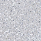 Immunohistochemical staining of human liver shows no positivity in hepatocytes as expected.