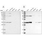 Western blot analysis using Anti-WRNIP1 antibody HPA031752 (A) shows similar pattern to independent antibody HPA031753 (B).