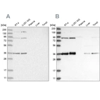 Western blot analysis using Anti-WRNIP1 antibody HPA031752 (A) shows similar pattern to independent antibody HPA031753 (B).