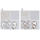 Anti-WRNIP1 Antibody