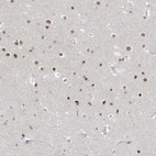 Immunohistochemical staining of human cerebral cortex shows moderate nuclear positivity in neurons.