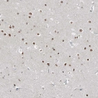 Immunohistochemical staining of human cerebral cortex shows moderate nuclear positivity in neurons.
