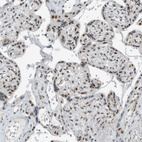 Immunohistochemical staining of human placenta shows moderate nuclear positivity in trophoblastic cells.