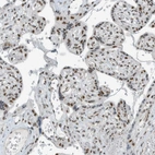 Immunohistochemical staining of human placenta shows moderate nuclear positivity in trophoblastic cells.