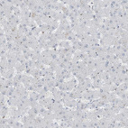 Immunohistochemical staining of human liver shows no positivity in hepatocytes as expected.