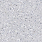 Immunohistochemical staining of human liver shows no positivity in hepatocytes as expected.