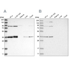Western blot analysis using Anti-WRNIP1 antibody HPA031753 (A) shows similar pattern to independent antibody HPA031752 (B).