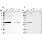 Western blot analysis using Anti-WRNIP1 antibody HPA031753 (A) shows similar pattern to independent antibody HPA031752 (B).